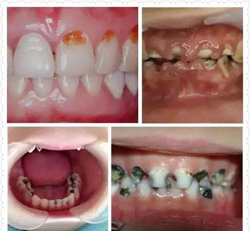 种植国产牙视频,视频带你领略创新与精湛