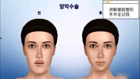 下颚骨手术国产视频,技术革新与患者康复之路